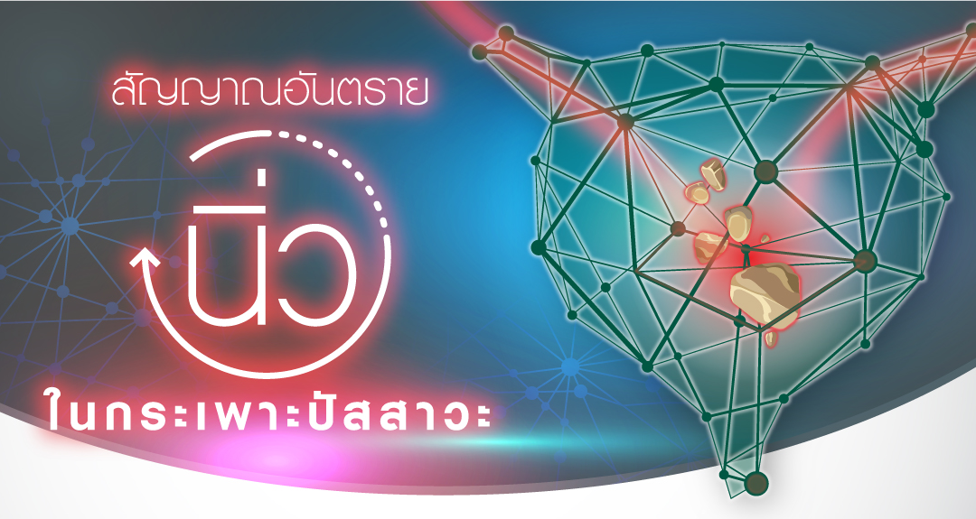 สัญญาณอันตราย “นิ่วในกระเพาะปัสสาวะ”