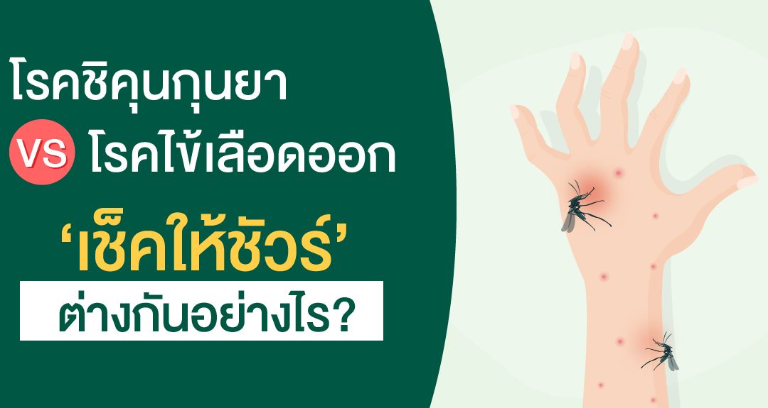 โรคชิคุนกุนยา VS โรคไข้เลือดออก อาการแตกต่างกันอย่างไร?