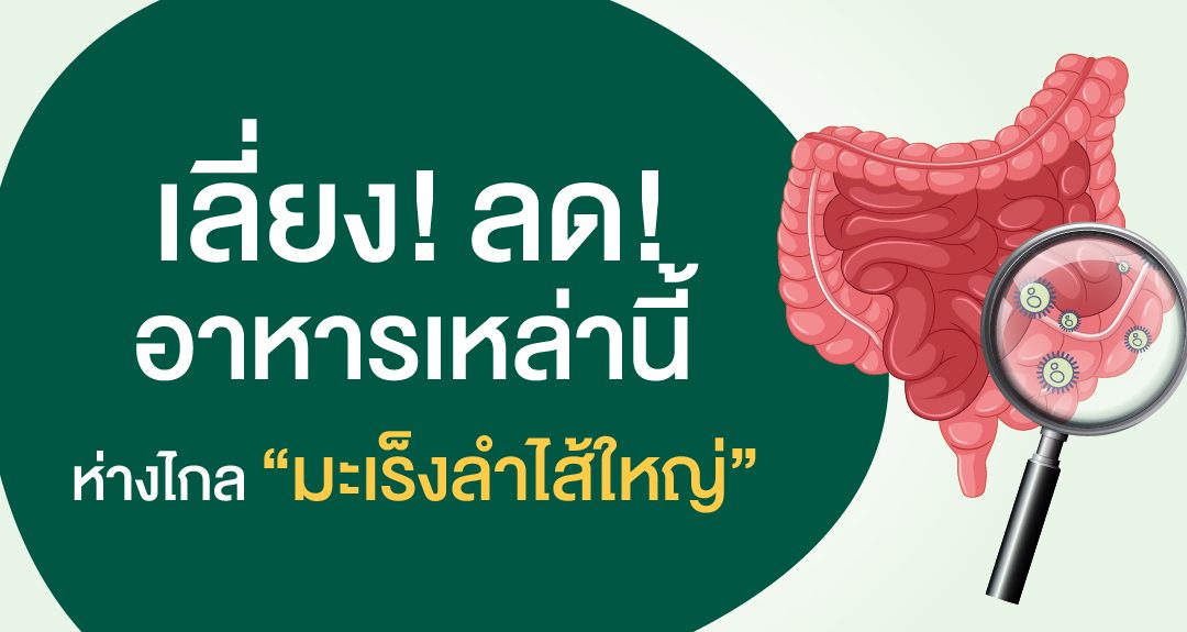 เลี่ยง! ลด! อาหารเหล่านี้…ห่างไกลมะเร็งลำไส้ใหญ่