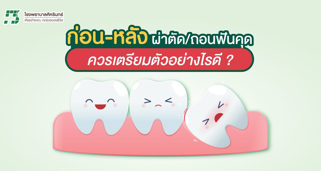 ฟันคุด ก่อน-หลัง ผ่าตัด/ถอน ต้องทำอะไรบ้าง?