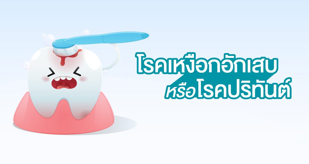 โรคเหงือกอักเสบ หรือโรคปริทันต์