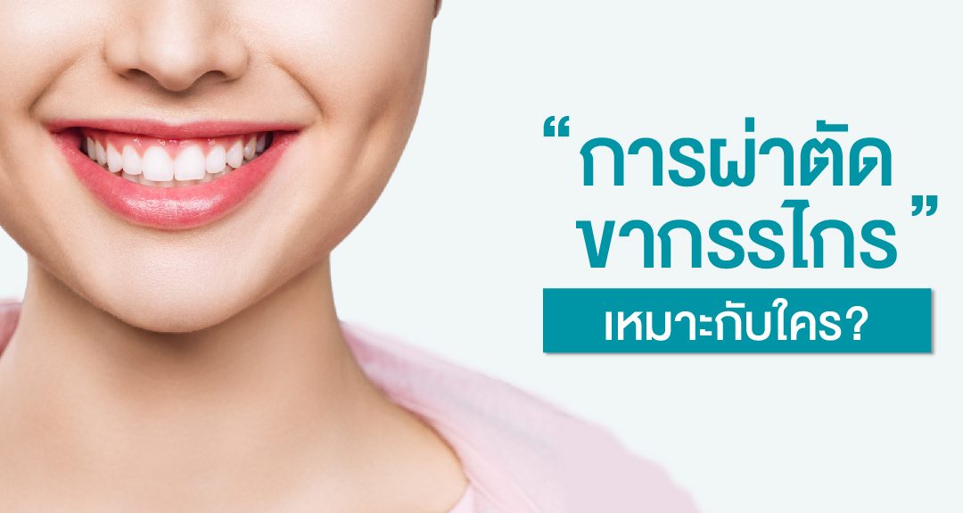‘ผ่าตัดขากรรไกร’ เหมาะกับใคร?