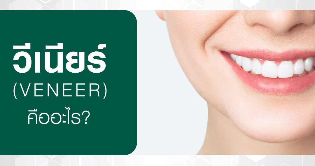 วีเนียร์ (VENEER) คืออะไร?