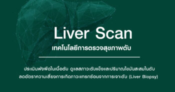 Liver Scan