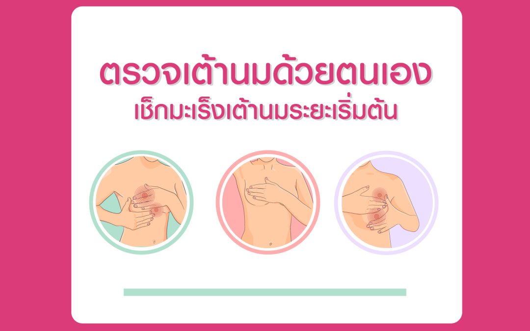 ตรวจเต้านมด้วยตนเอง เช็กมะเร็งเต้านมระยะเริ่มต้น