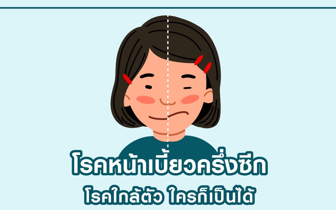 โรคหน้าเบี้ยวครึ่งซีก โรคใกล้ตัว ใครก็เป็นได้