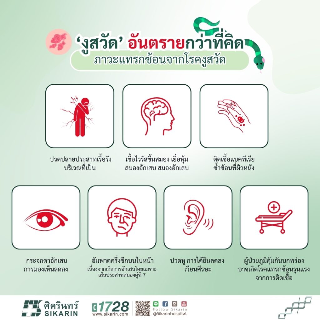 งูสวัด