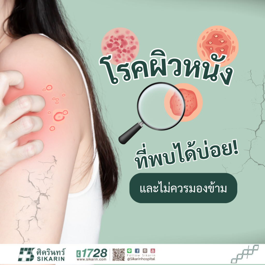 โรคผิวหนัง