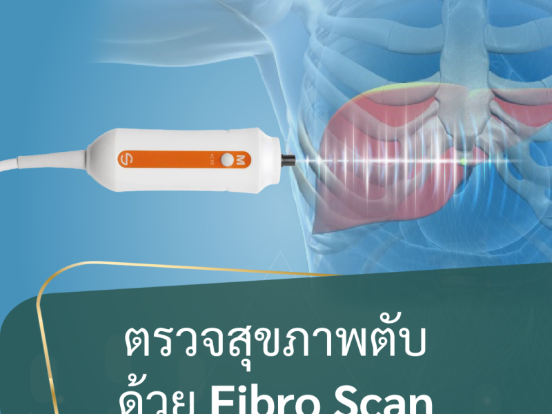 แพ็กเกจตรวจสุขภาพตับ: ตรวจพังผืดและไขมันสะสมด้วย FibroScan (ไฟโบรสแกน)